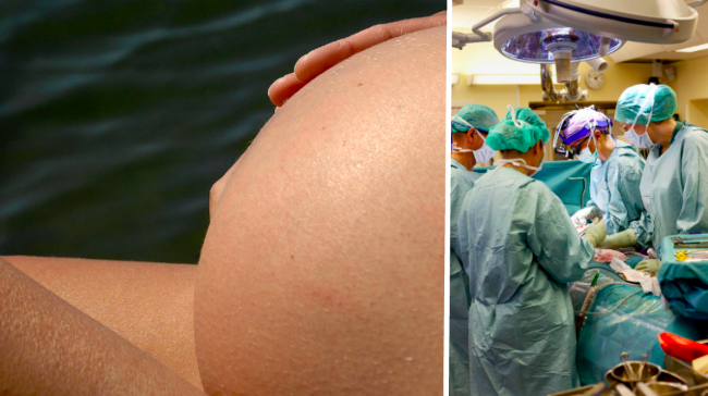 Gravid, operation